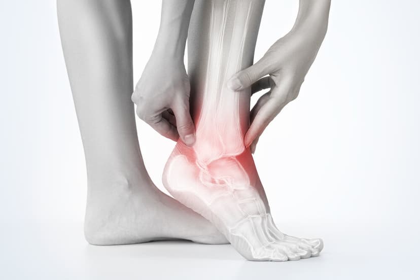 Hurt Ankle